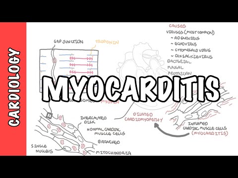 Cardiovascular System Anatomy