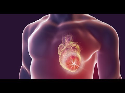Importante: O que fazer em caso de ataque cardíaco?