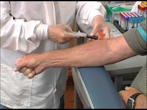 Part of a video titled How to perform a venipuncture using a syringe - YouTube