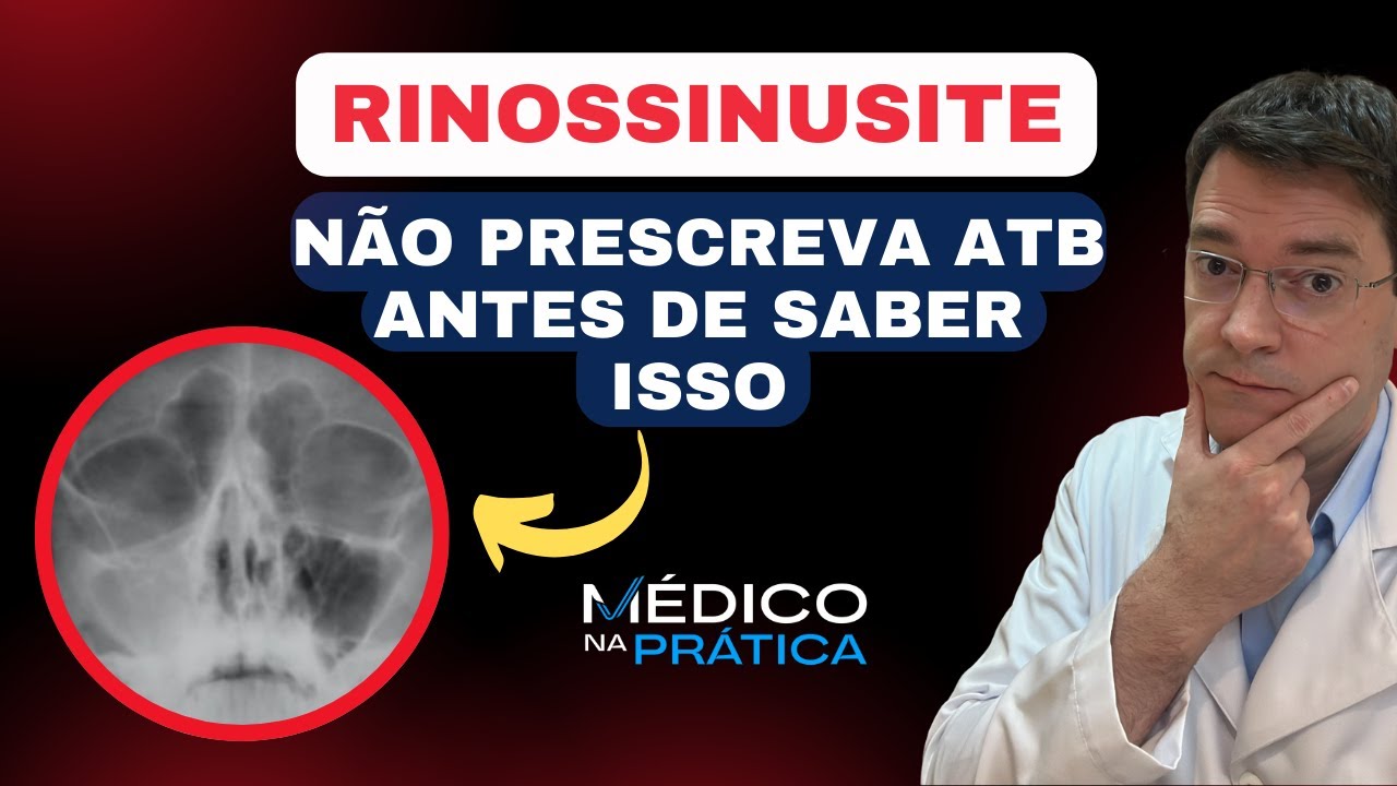 Acute Rhinosinusitis - Know when to correctly prescribe ATB