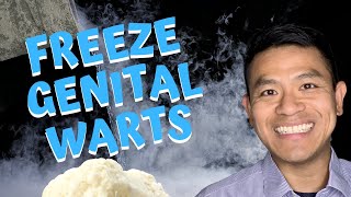 Freezing Genital Warts | How to Get Rid of Human Papilloma Virus  (HPV) using Cryotherapy