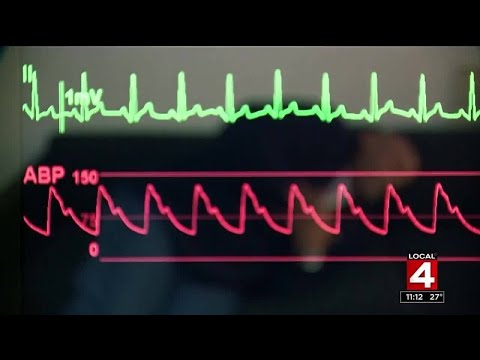 What does having a heart attack feel like?