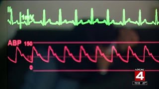 Download lagu What does having a heart attack feel like? mp3