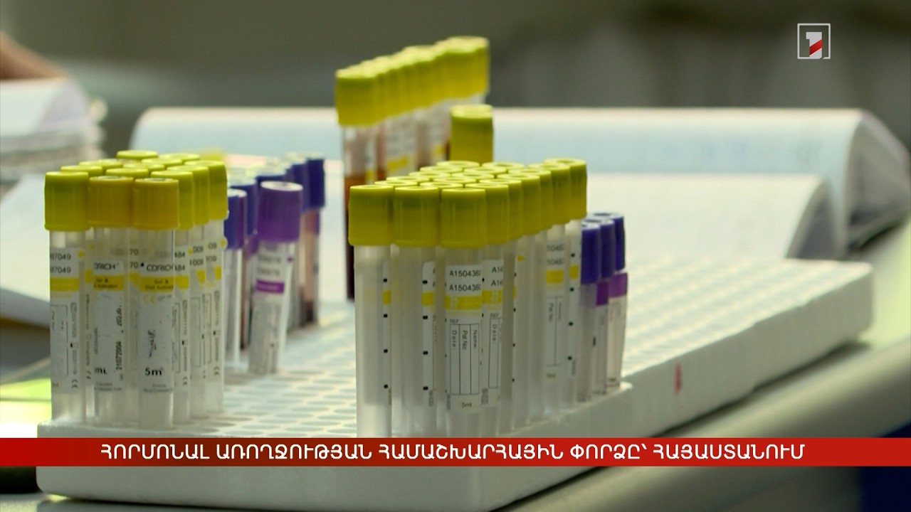 Հորմոնալ առողջության համաշխարհային փորձը՝ Հայաստանում