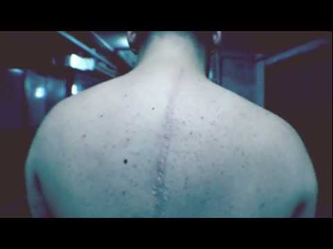 Broke N Spuork (Dekasettimo , Oyoshe) - Vivo Tra (Prod.Oni) Skratch by 2Mani (Official Video)