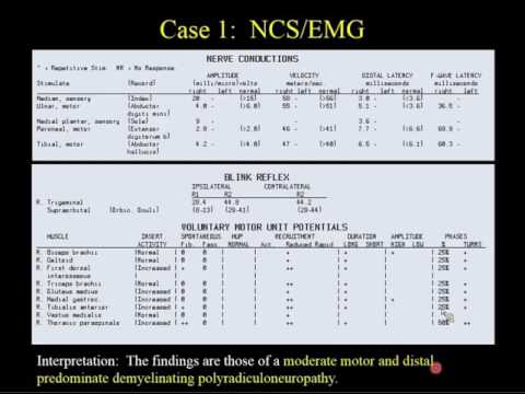 Autoimmune Polyradiculoneurolopathy and a Novel IgG Biomarker