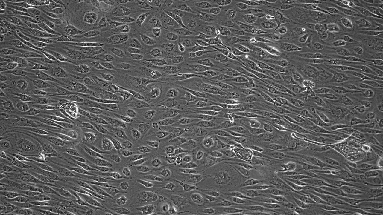 HMVEC Cell alignment 5days under flow at 10dyn