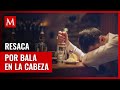 Hombre Descubre Bala En La Cabeza Tras 4 Días De Fiesta