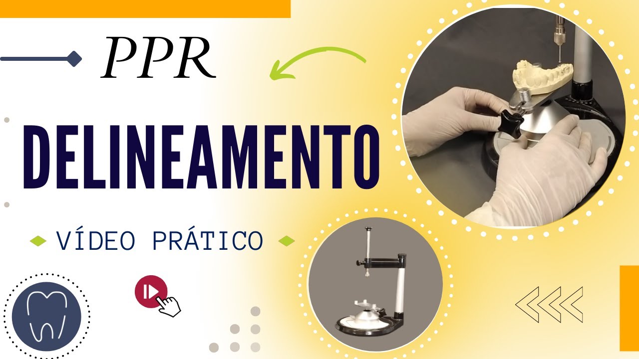 DELINEAMENTO PPR - Passos do planejamento