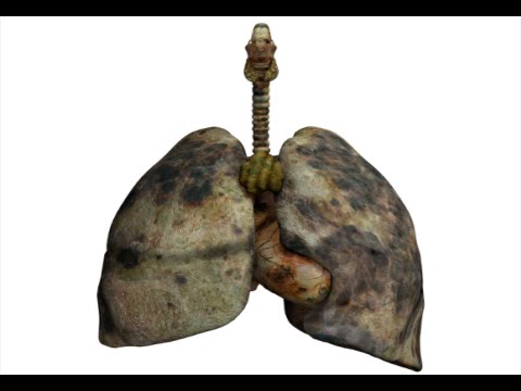 How to Detox Smokers Lungs - Lung Cleanse For Smokers