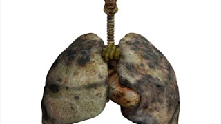 How to Detox Smokers Lungs