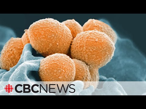 Several U.K. children die in strep A outbreak