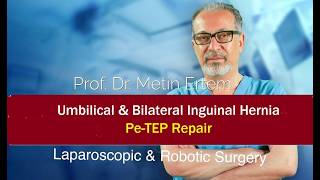 Miniaturka - Laparoscopic Pe-TEP Repair. Umbilical & Bilateral inguinal hernia. Metin Ertem MD.FACS