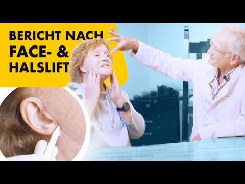 Face- und Halslift in nur einem Eingriff! Erfahrungsbericht | Dr. Jungwirth - Plastische Chirurgie