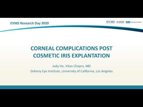 Thumbnail image of video presentation for Corneal Complications Post Cosmetic Iris Explantation