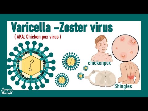 Varicella Zoster Virus | Chicken pox and Shingles | pathology , diagnosis and treatment