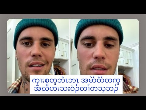 Justin Bieber's face paralyze 6/12/2022