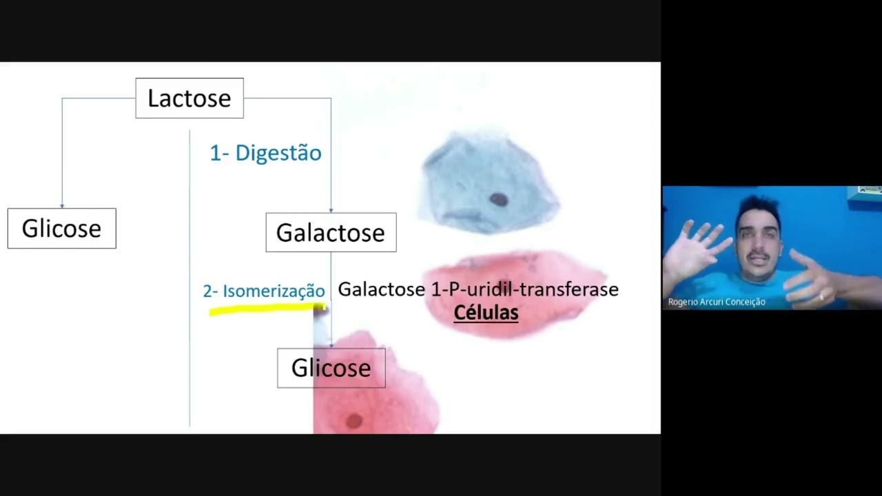 Carboidratos: Intolerância a lactose e metabolismo da galactose