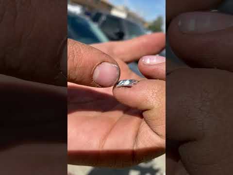 My dad’s fingernails about to fall off look