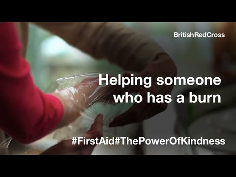 First Aid | Helping someone who has a burn | British Red Cross