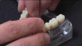 Stony Brook, NY  Implant Dentistry  Dr. Jimmy Kilimitzoglou