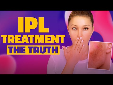 THE TRUTH ABOUT Intense Pulsed Light Therapy IPL Treatment
