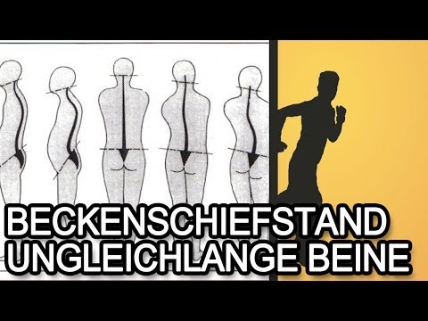 Russische Kniegelenkprothese Windelausschlag bei Säuglingen um den Hals Behandlung