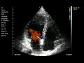 Portable USB Wifi Cardiac Ultrasound Scanner