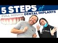 Full Mouth Dental Implant Procedure Step-by-Step