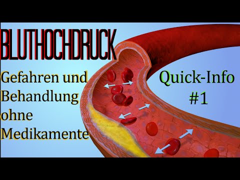 Ich habe Bluthochdruck, aber manchmal der Druck fällt scharf ab, was es ist Standards der Pflege von Hypertonie im Krankenhaus