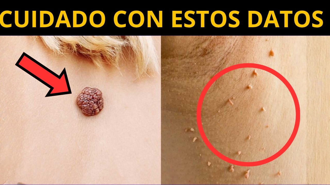 NO IGNORES ESTO: 5 señales tempranas de que tienes RESISTENCIA A LA INSULINA