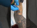 SUSLASER Picolaser Tattoo Removal Whole Arm Tattoo Removal With Less Chance Of Forming Bubbles