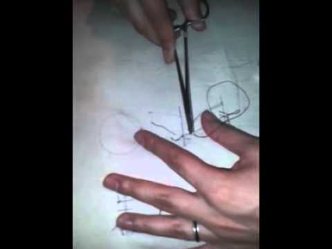 punto quirúrgico blair-donati