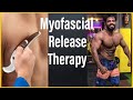 myofascia release therapy