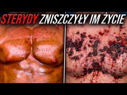 Osoby, którym Sterydy ZNISZCZYŁY ŻYCIE