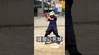 強肩強打の野球少女がデッドボールで救急搬送 #shorts