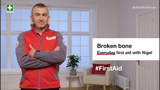 Broken bone: First aid steps and key action