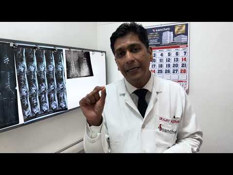 Post spine surgery Spine infection: How to treat
