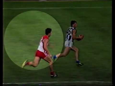 1991 Shaun Smith concussion.  An example of how far we have come treating concussion during play