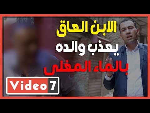 الابن العاق.. يعذب والده بالماء المغلى ويستولى على ثروته بتحريض من زوجته