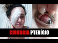 DIÁRIO DA MINHA CIRURGIA DO PTERÍGIO ANTES E DEPOIS