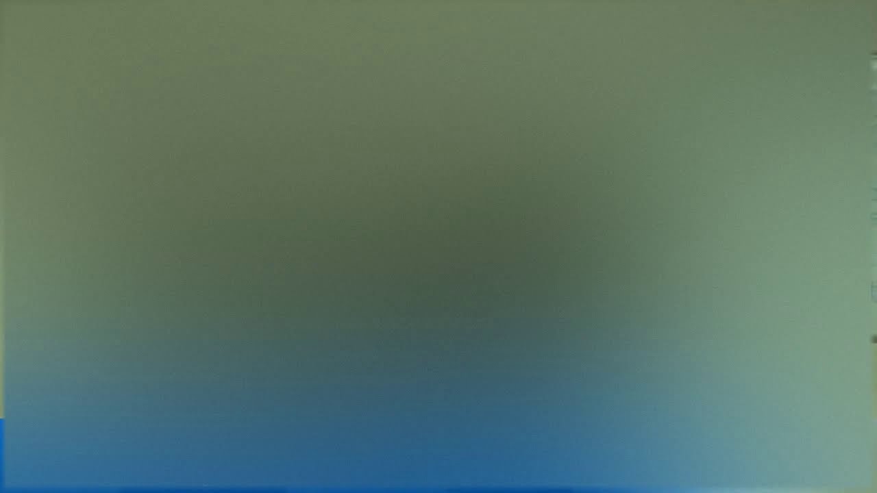 Thumbnail of video: Guéri de 15 ans d'hémorroïde (28/11/15)