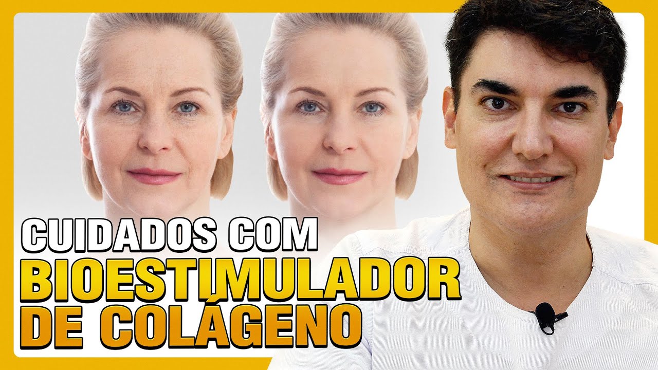 BIOESTIMULADORES DE COLÁGENO | Cuidados com os efeitos colaterais