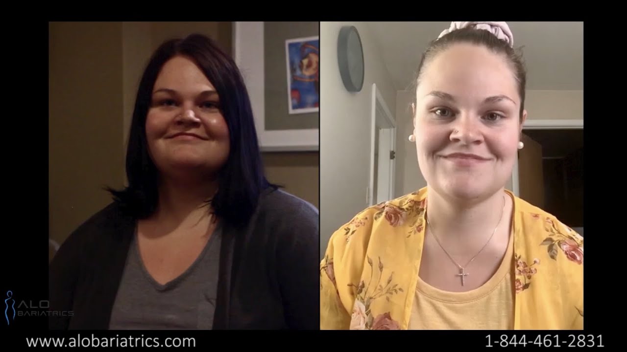 Gastric Sleeve Patient Story
