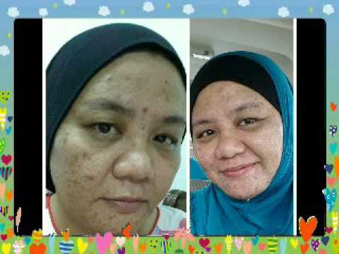 Testimoni Aida Voc de beaute.