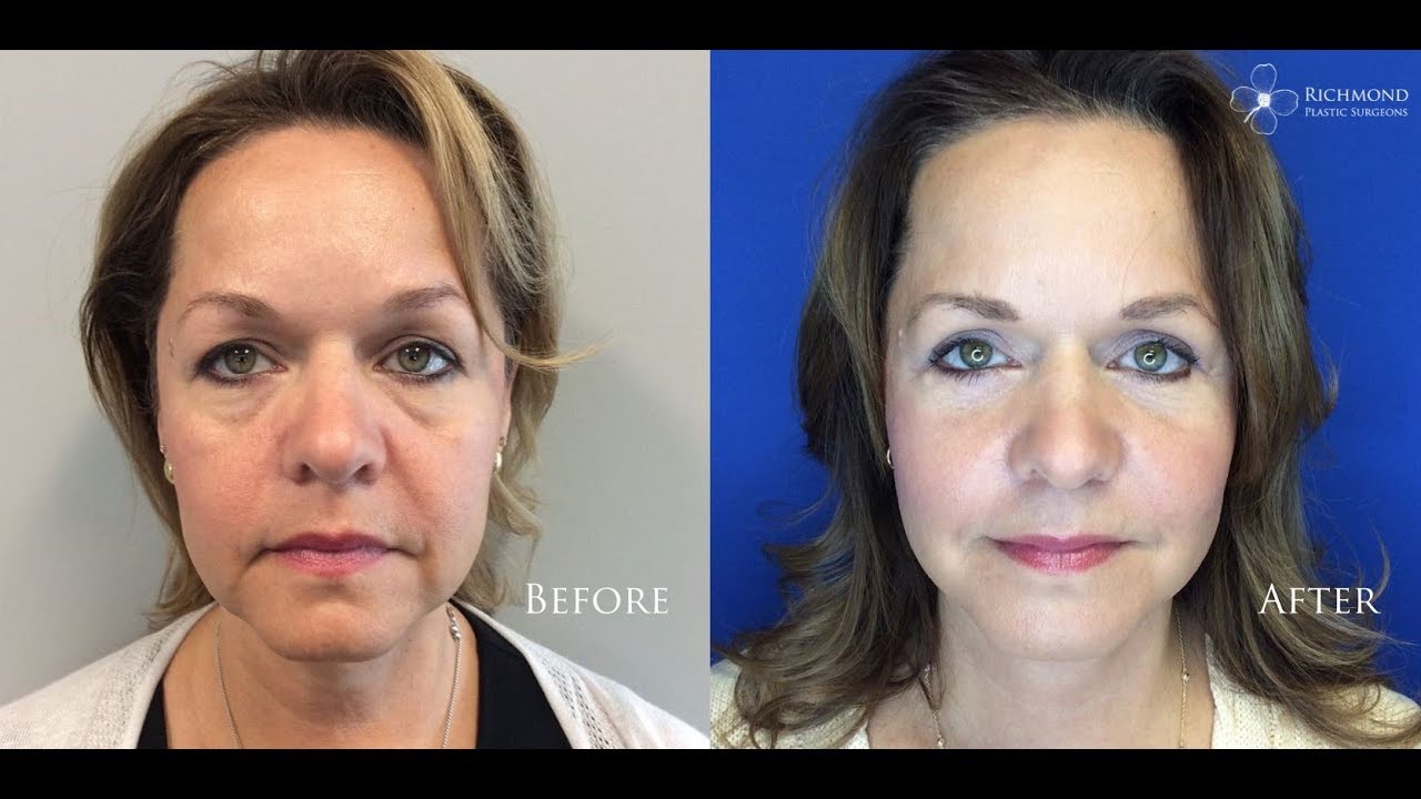 Richmond Plastic Surgeons