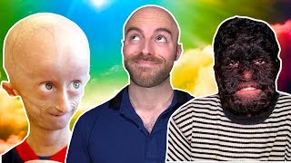 10 People Who Were Miraculously Cured!