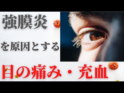 強膜炎