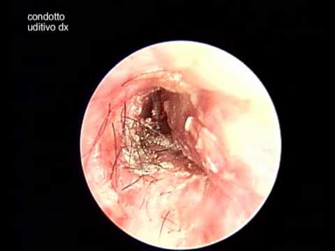 Di una protesi danca nelle cliniche di Mosca Come mettere le lattine sottovuoto allosteocondrosi