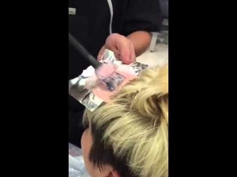 Mimetizzazione di tatuaggio di posti pigmentary di una fotografia Le procedure per eliminazione di pigmentary notano su una faccia